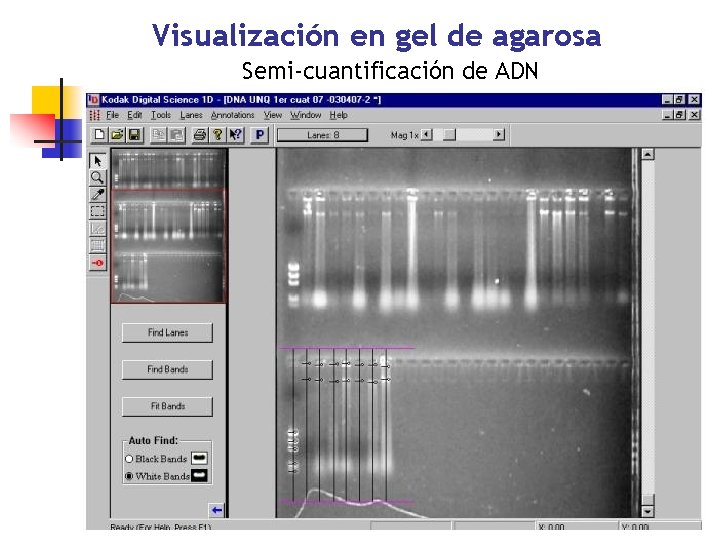Visualización en gel de agarosa Semi-cuantificación de ADN 