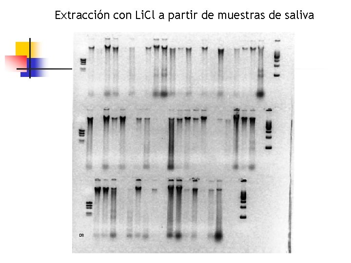 Extracción con Li. Cl a partir de muestras de saliva G 8 