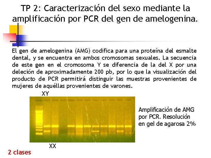 TP 2: Caracterización del sexo mediante la amplificación por PCR del gen de amelogenina.