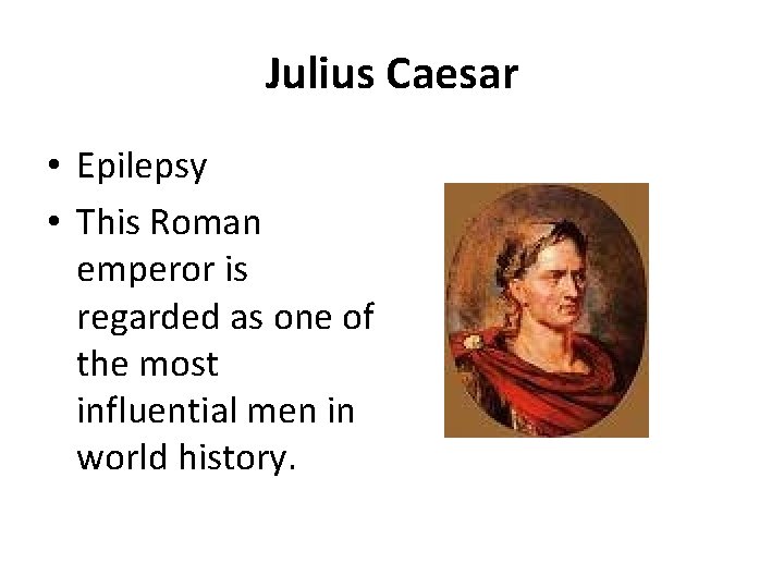 Julius Caesar • Epilepsy • This Roman emperor is regarded as one of the