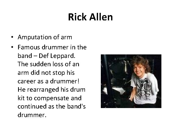 Rick Allen • Amputation of arm • Famous drummer in the band – Def