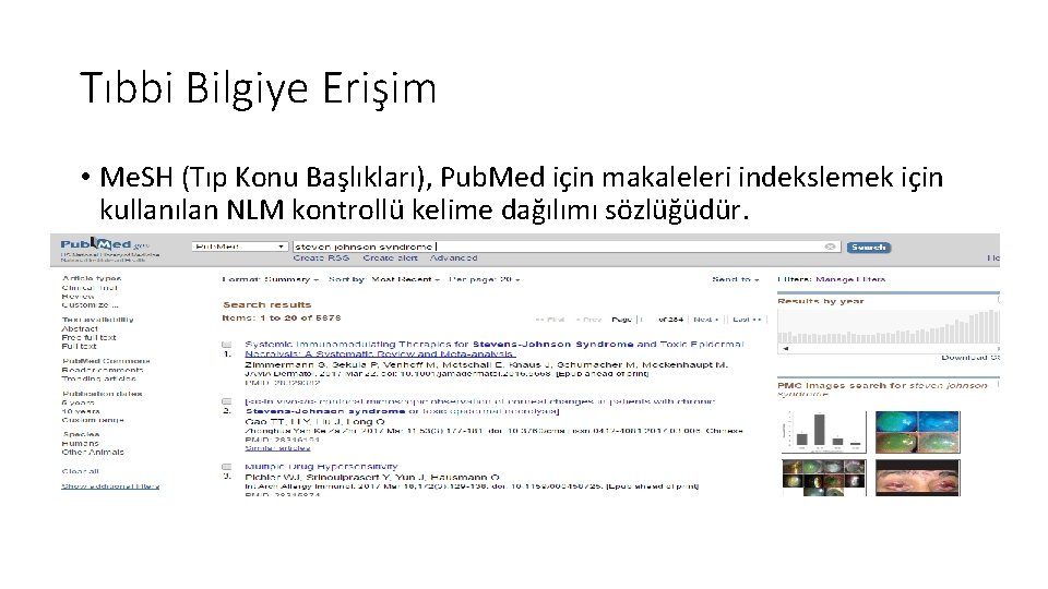 Tıbbi Bilgiye Erişim • Me. SH (Tıp Konu Başlıkları), Pub. Med için makaleleri indekslemek