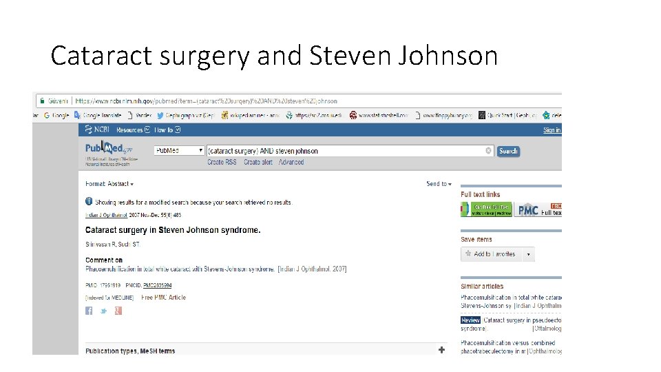 Cataract surgery and Steven Johnson 