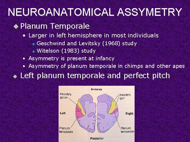NEUROANATOMICAL ASSYMETRY u Planum Temporale • Larger in left hemisphere in most individuals Geschwind