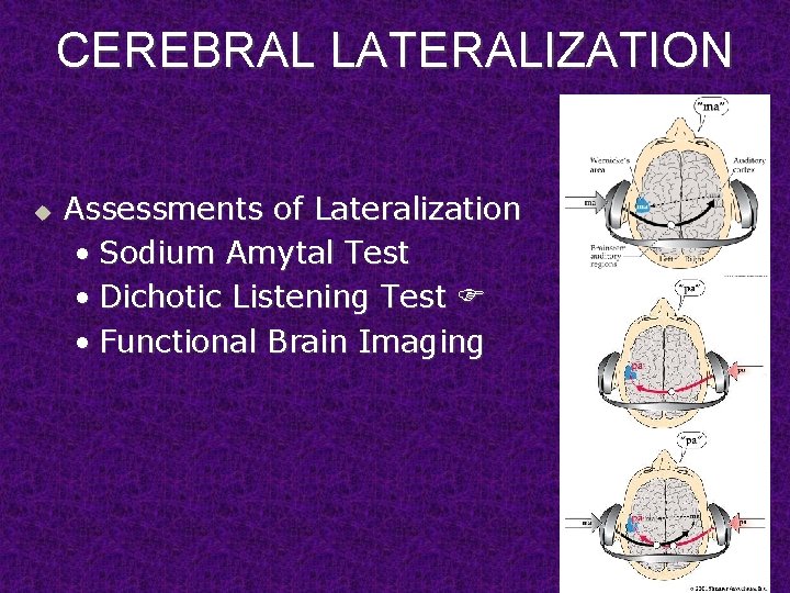 CEREBRAL LATERALIZATION u Assessments of Lateralization • Sodium Amytal Test • Dichotic Listening Test