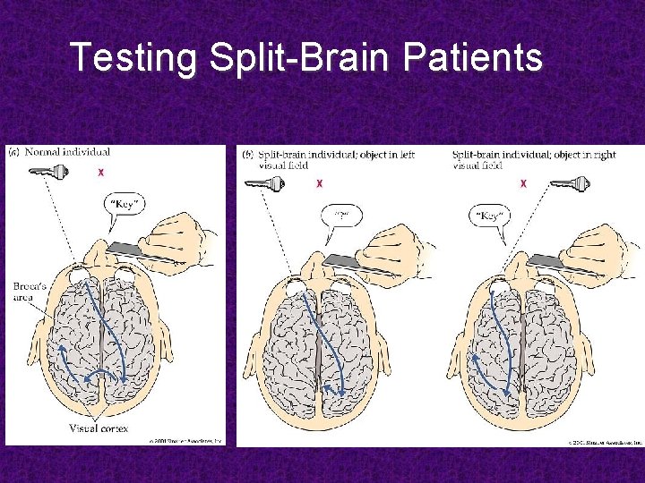 Testing Split-Brain Patients 