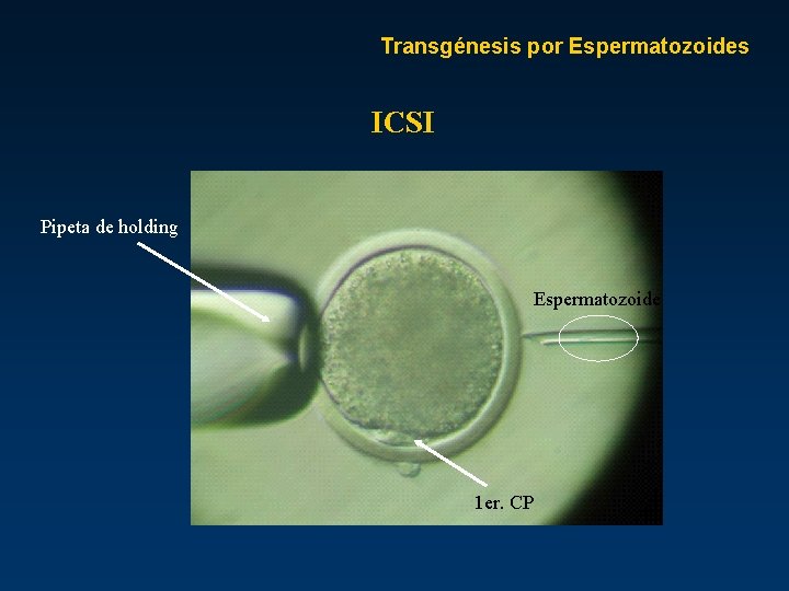 Transgénesis por Espermatozoides ICSI Pipeta de holding Espermatozoide 1 er. CP 