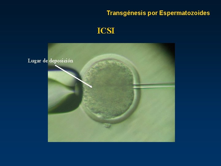 Transgénesis por Espermatozoides ICSI Lugar de deposición 