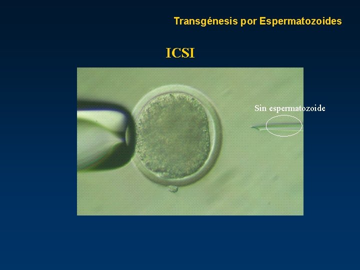 Transgénesis por Espermatozoides ICSI Sin espermatozoide 