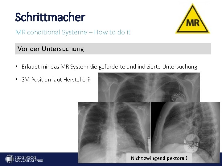 Schrittmacher MR conditional Systeme – How to do it Vor der Untersuchung • Erlaubt