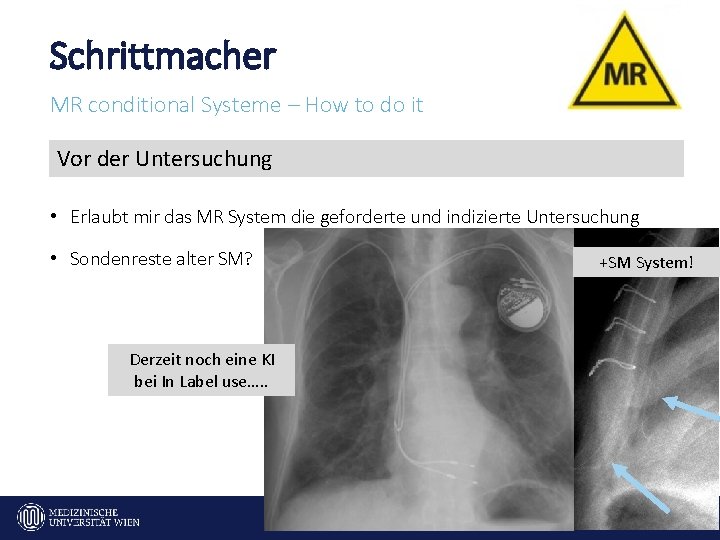 Schrittmacher MR conditional Systeme – How to do it Vor der Untersuchung • Erlaubt