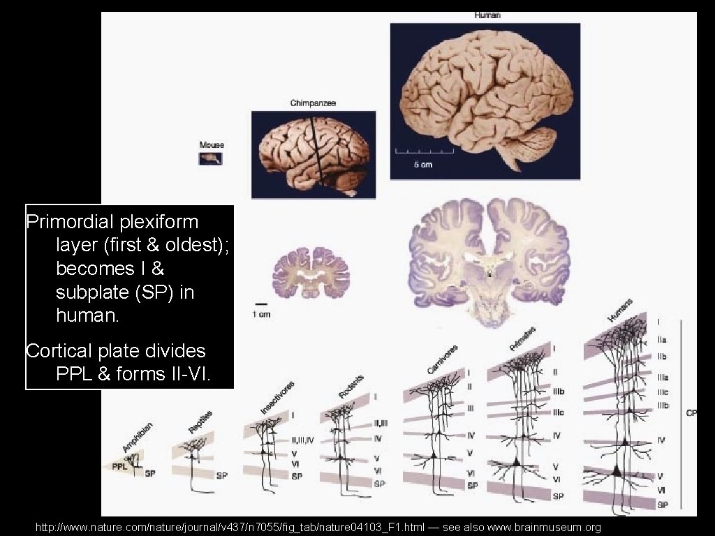 Primordial plexiform layer (first & oldest); becomes I & subplate (SP) in human. Cortical