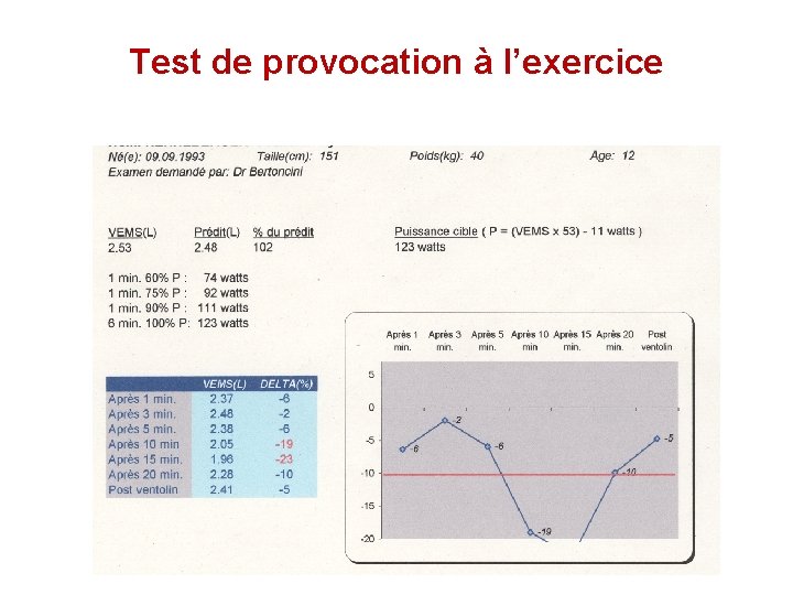 Test de provocation à l’exercice 