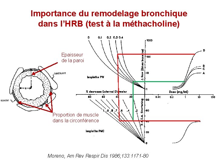 Importance du remodelage bronchique dans l’HRB (test à la méthacholine) Epaisseur de la paroi