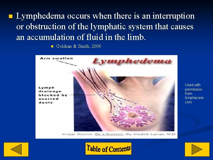 n Lymphedema occurs when there is an interruption or obstruction of the lymphatic system