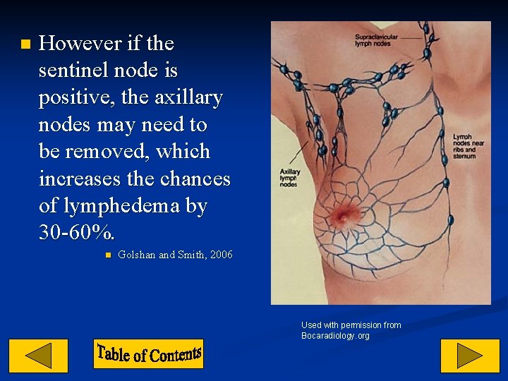 n However if the sentinel node is positive, the axillary nodes may need to