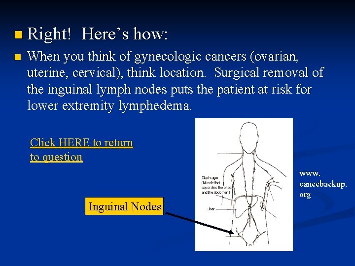 n Right! n Here’s how: When you think of gynecologic cancers (ovarian, uterine, cervical),