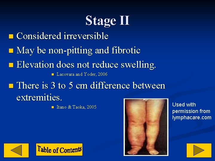 Stage II Considered irreversible n May be non-pitting and fibrotic n Elevation does not