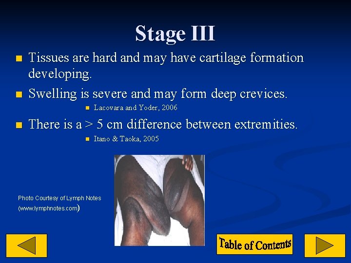 Stage III n n Tissues are hard and may have cartilage formation developing. Swelling