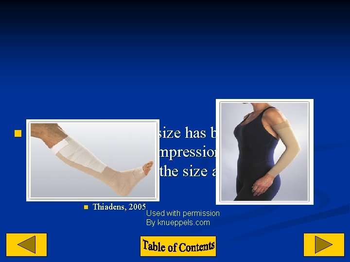 n Once a manageable size has been achieved from wrapping, a compression stocking may