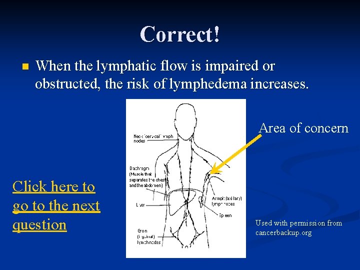 Correct! n When the lymphatic flow is impaired or obstructed, the risk of lymphedema