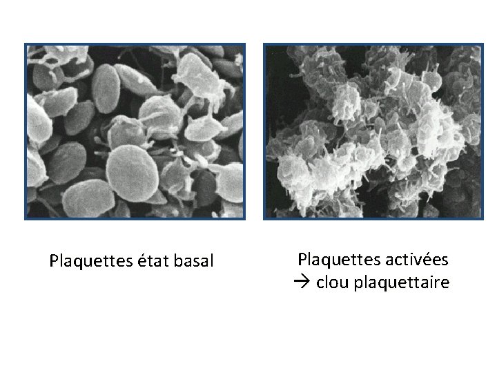 Plaquettes état basal Plaquettes activées clou plaquettaire 