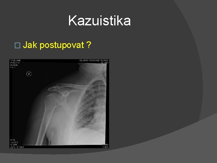 Kazuistika � Jak postupovat ? 