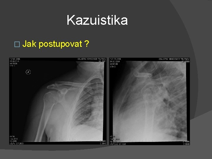 Kazuistika � Jak postupovat ? 