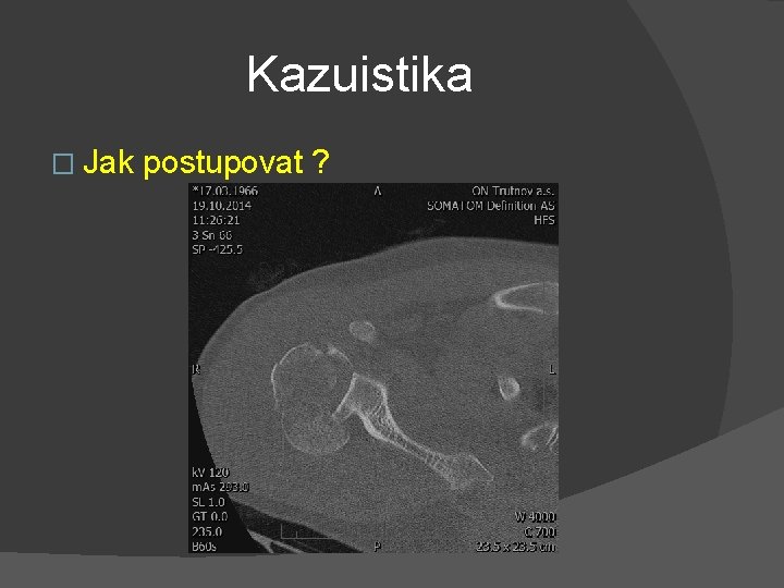 Kazuistika � Jak postupovat ? 