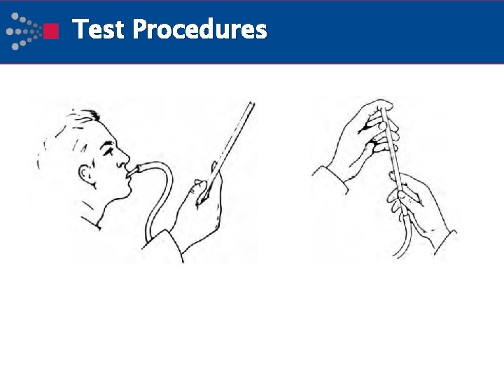 Test Procedures 