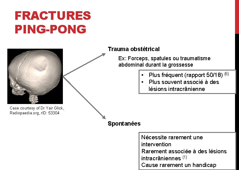 FRACTURES PING-PONG Trauma obstétrical Ex: Forceps, spatules ou traumatisme abdominal durant la grossesse •