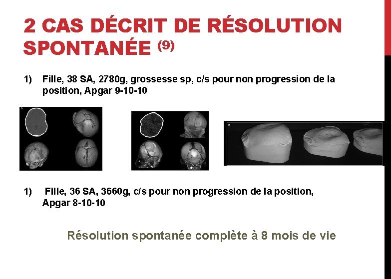 2 CAS DÉCRIT DE RÉSOLUTION SPONTANÉE (9) 1) Fille, 38 SA, 2780 g, grossesse