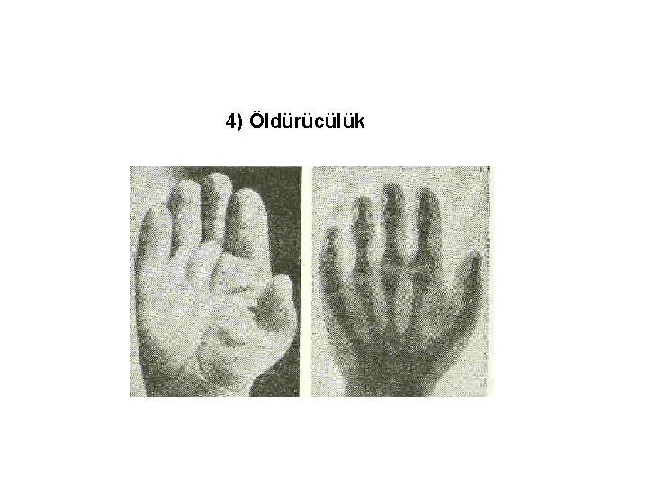 4) Öldürücülük 