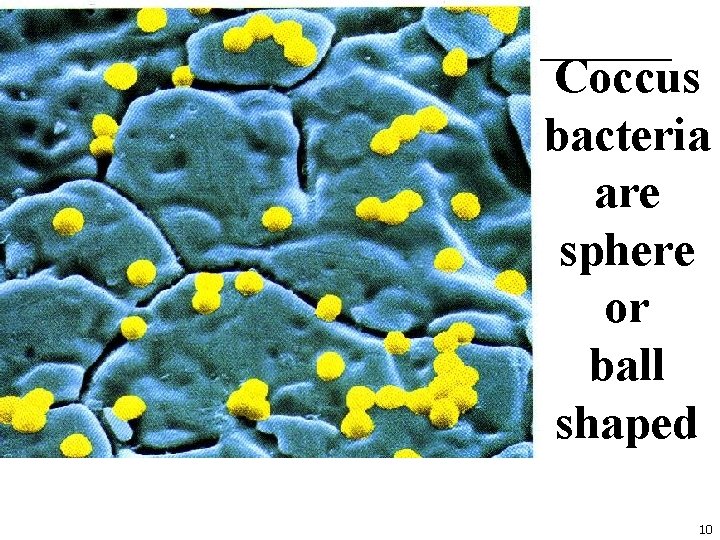 Coccus bacteria are sphere or ball shaped 10 