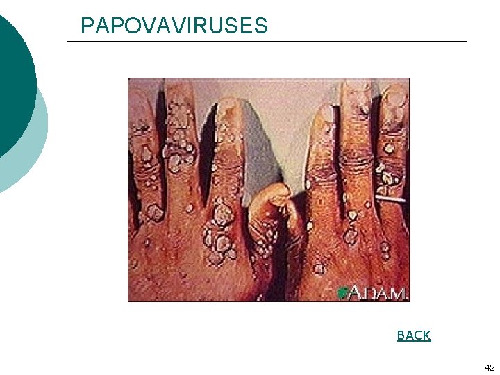 PAPOVAVIRUSES BACK 42 