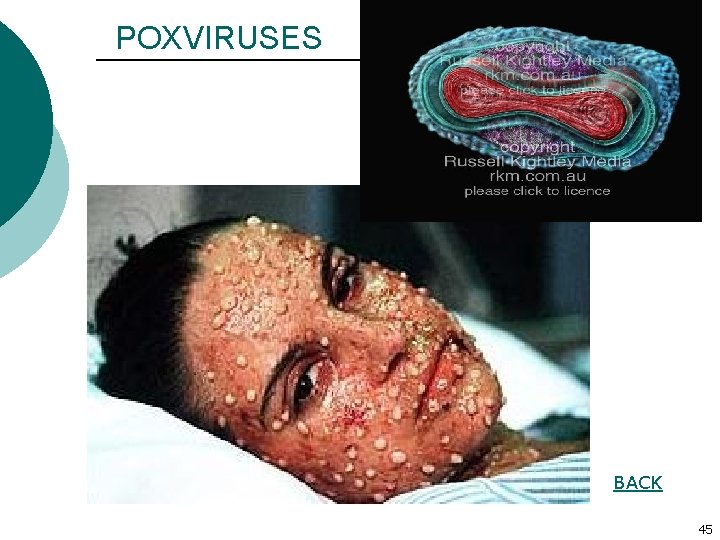 POXVIRUSES BACK 45 