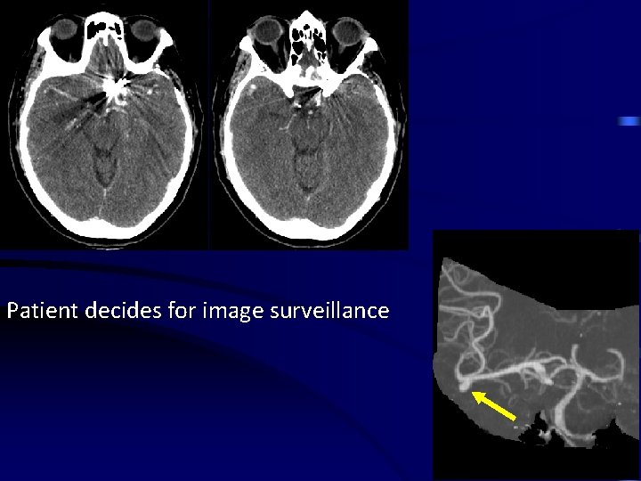 Patient decides for image surveillance 