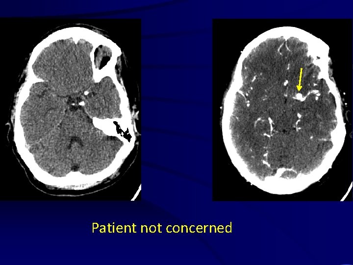 Patient not concerned 