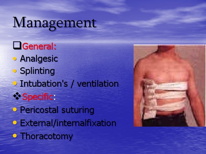Management q. General: • Analgesic • Splinting • Intubation's / ventilation v. Specific: •