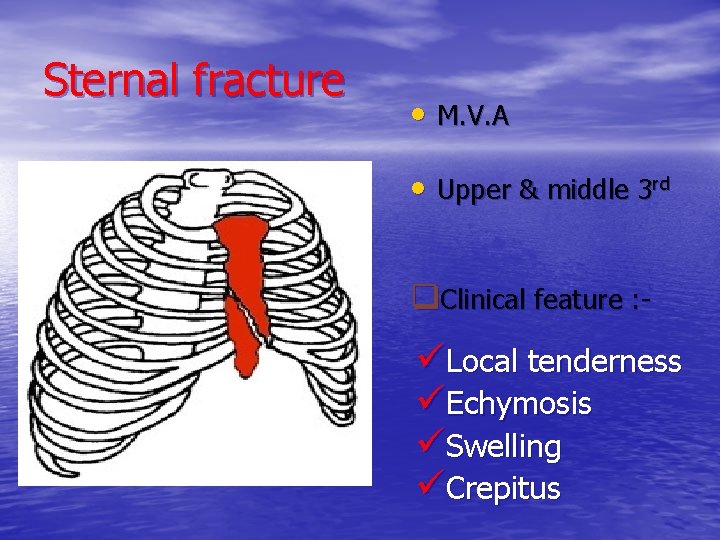 Sternal fracture • M. V. A • Upper & middle 3 rd q. Clinical