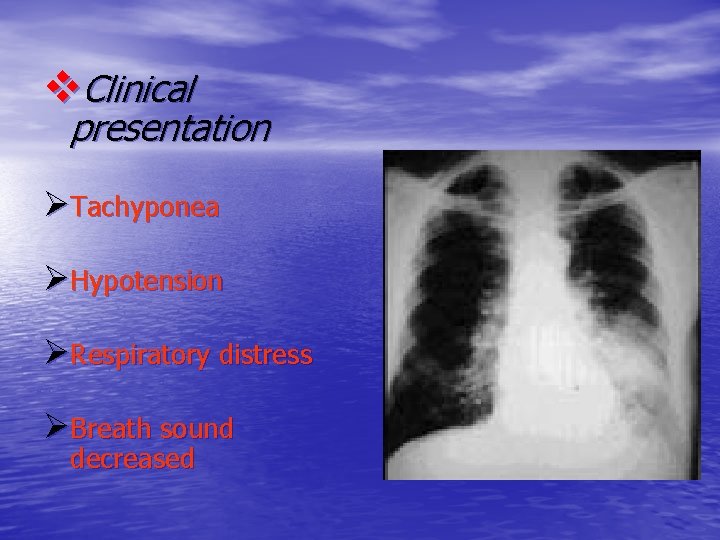v. Clinical presentation ØTachyponea ØHypotension ØRespiratory distress ØBreath sound decreased 