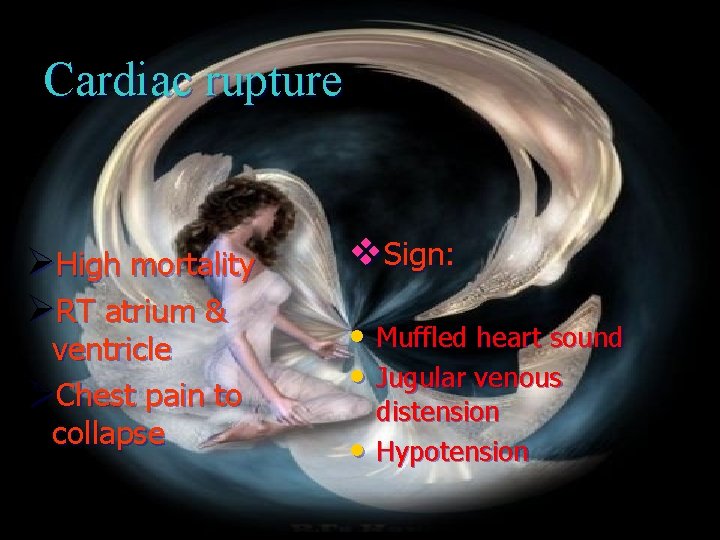 Cardiac rupture ØHigh mortality ØRT atrium & ventricle ØChest pain to collapse v. Sign: