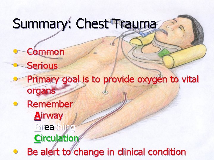 Summary: Chest Trauma • • • Common Serious Primary goal is to provide oxygen