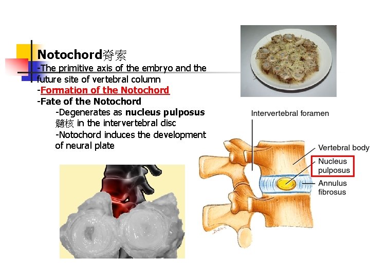 Notochord脊索 -The primitive axis of the embryo and the future site of vertebral column