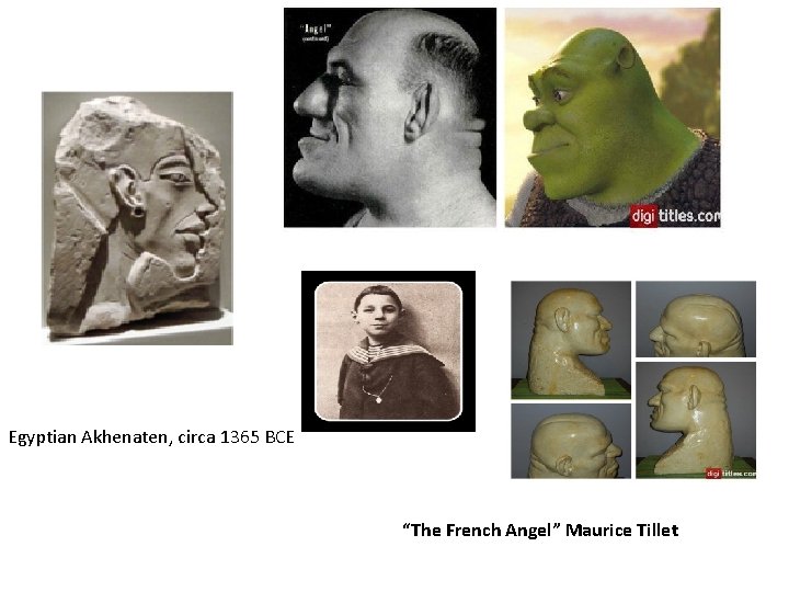 Egyptian Akhenaten, circa 1365 BCE “The French Angel” Maurice Tillet 
