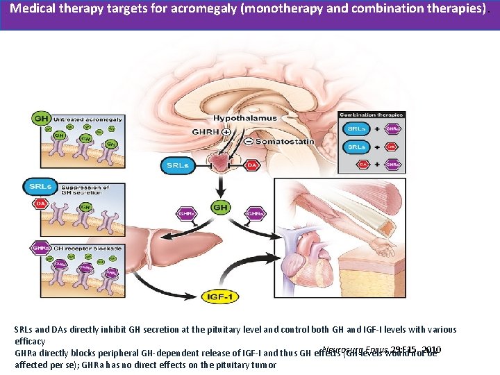 Μedical therapy targets for acromegaly (monotherapy and combination therapies). SRLs and DAs directly inhibit