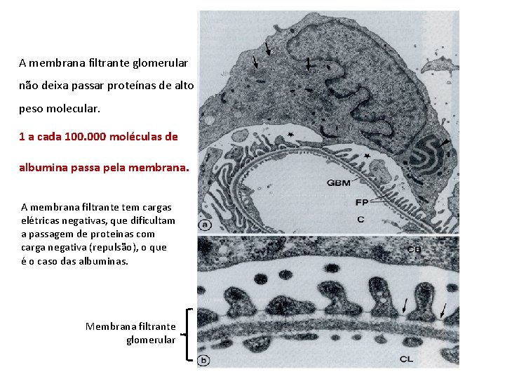 A membrana filtrante glomerular não deixa passar proteínas de alto peso molecular. 1 a