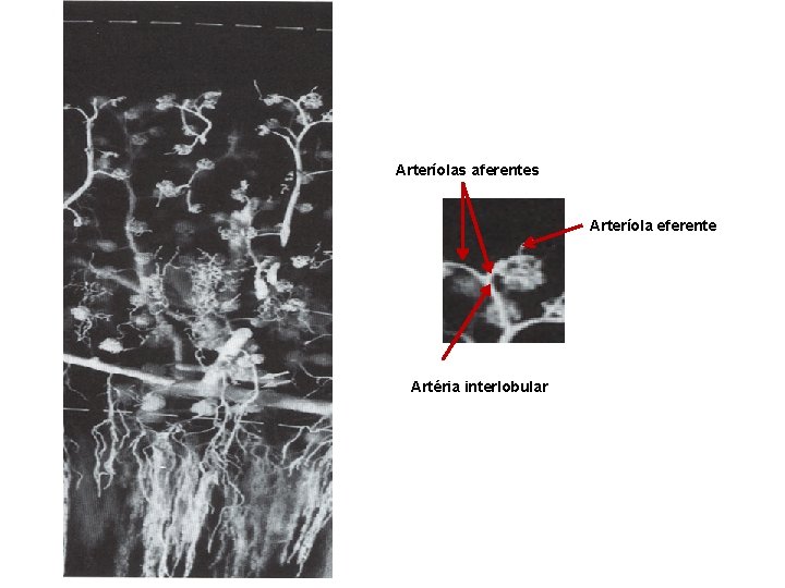 Arteríolas aferentes Arteríola eferente Artéria interlobular 