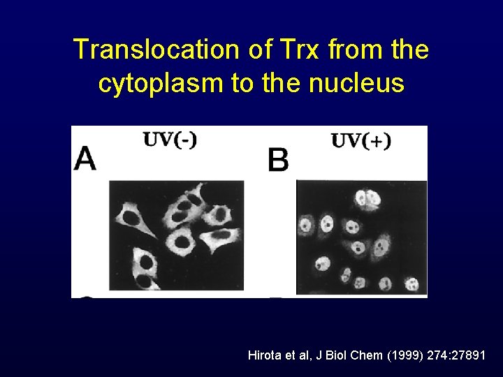 Translocation of Trx from the cytoplasm to the nucleus Hirota et al, J Biol