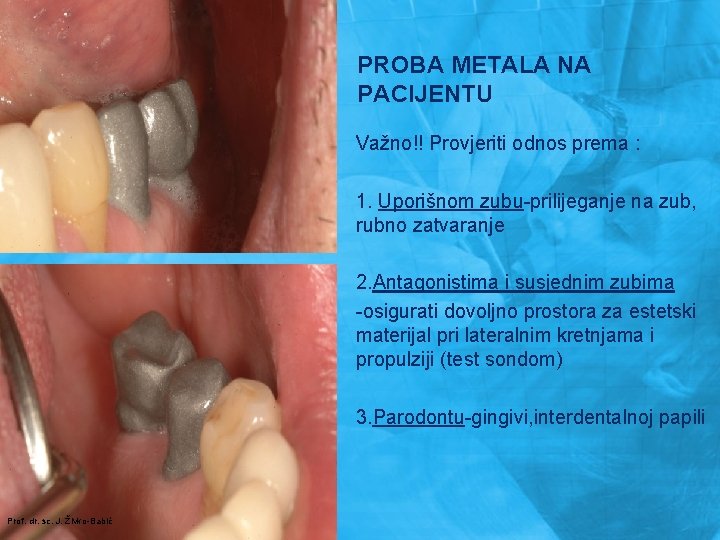 PROBA METALA NA PACIJENTU Važno!! Provjeriti odnos prema : 1. Uporišnom zubu-prilijeganje na zub,